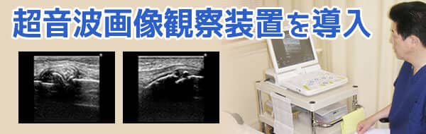 超音波画像観察装置を導入